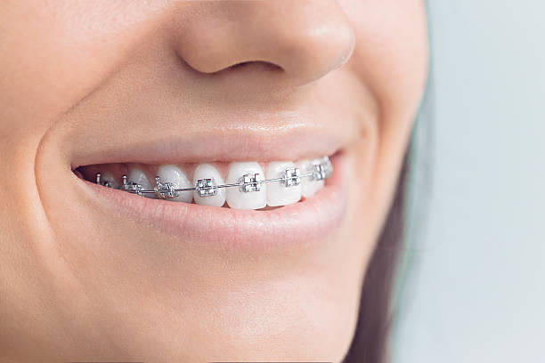 Best Dental Implants  in , CO